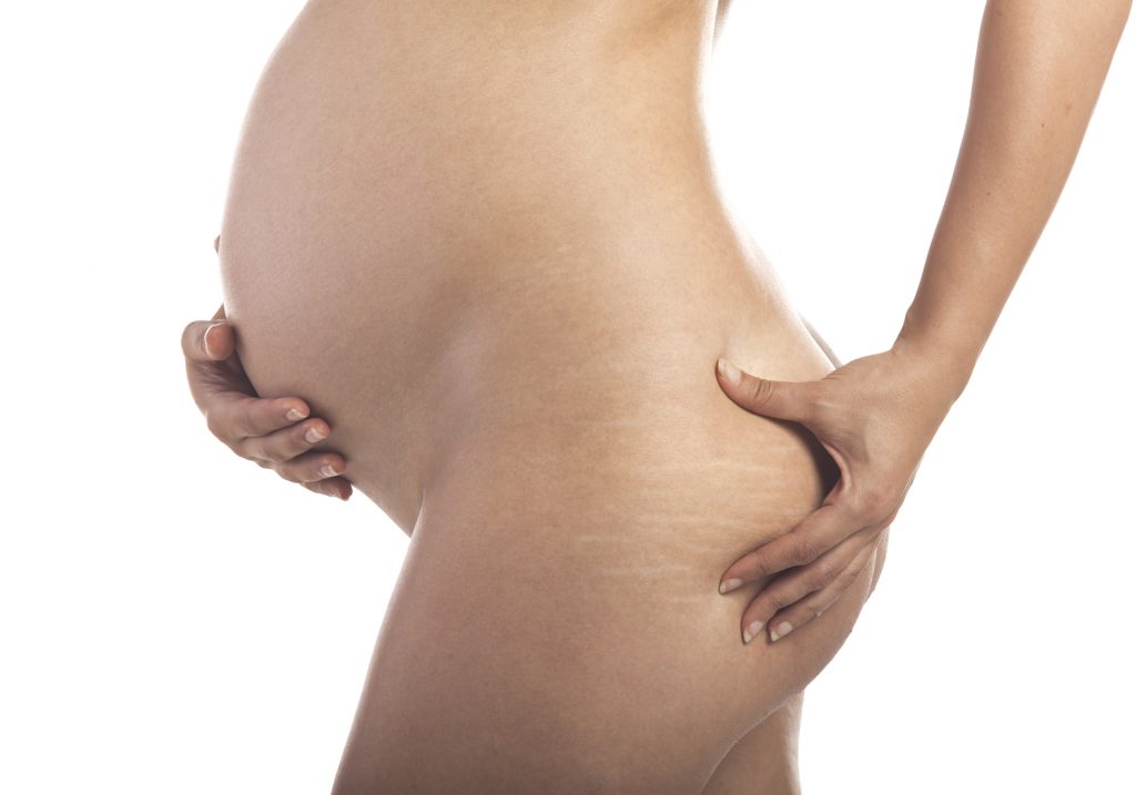 Afin d'éviter les vergetures, une femme enceinte doit prendre soin de son corps et le masser régulièrement.