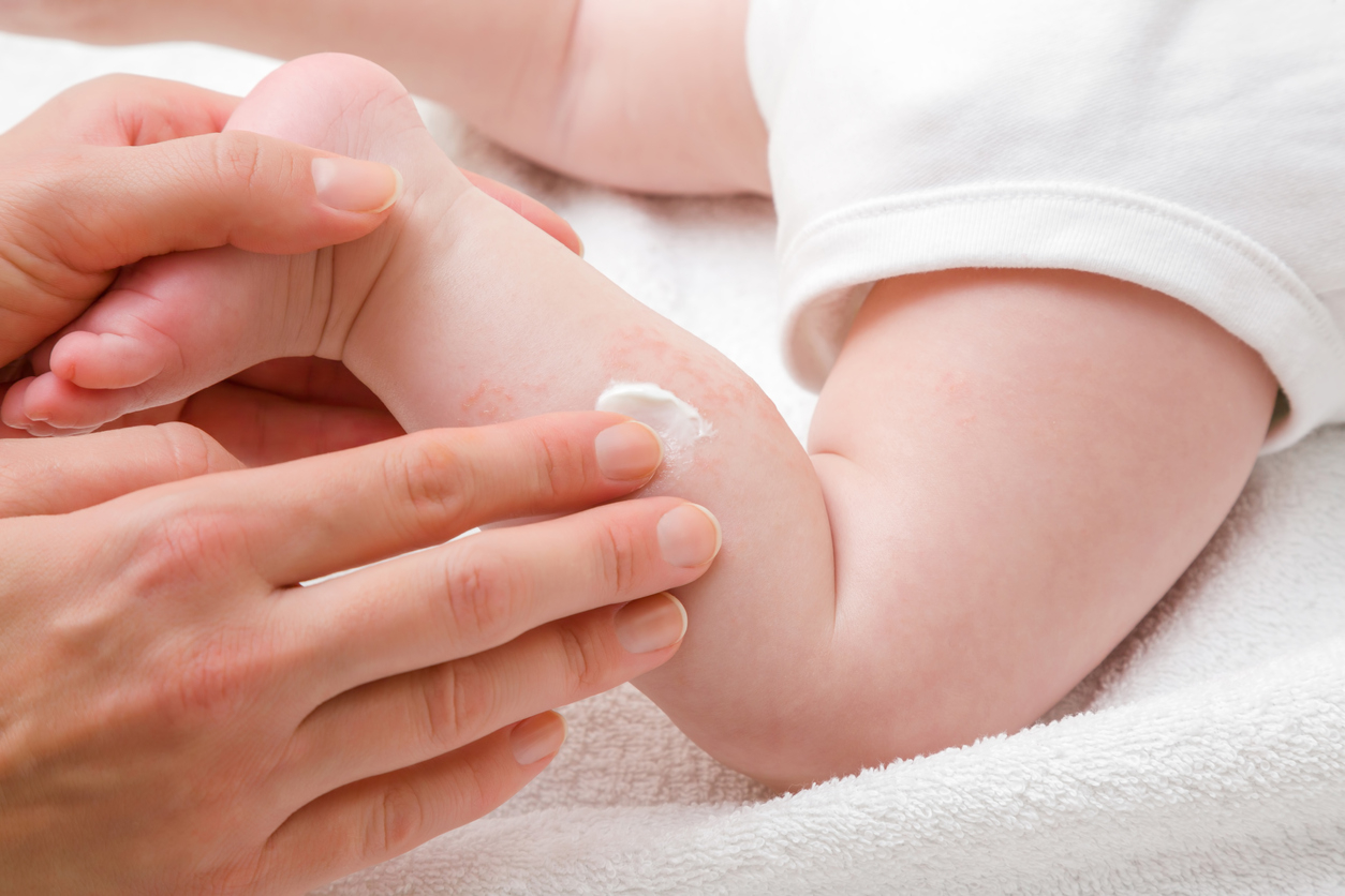 Si bébé a la peau sèche, il faut l'hydrater avec une crème.